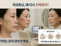 피코토닝 효과, 왜 잠깐 좋아졌다가 다시 진해질까 피코토닝 효과, 왜 잠깐 좋아졌다가 다시 진해질까